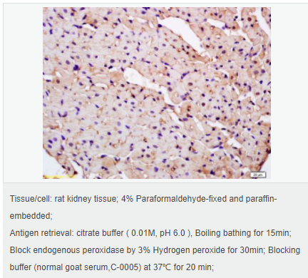 6058391f4021a.png image.png