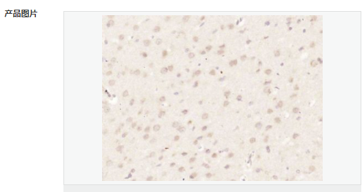 60583a1a10057.png image.png