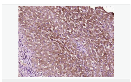 605850a09f342.png image.png