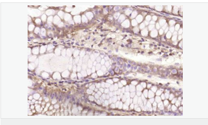 605944f25d15f.png image.png