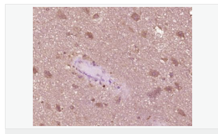 606410f436620.png image.png