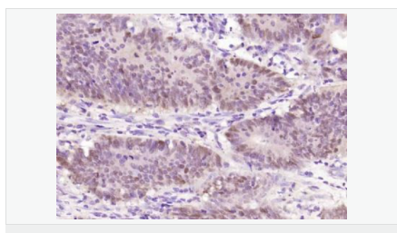 606bd494212ca.png image.png