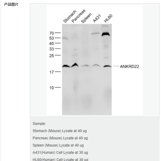 6076401c6fe25.png image.png